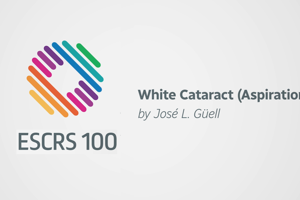 White Cataract (Aspiration)  - José.L. Güell