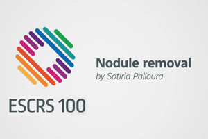 Nodule removal - Sotiria Palioura