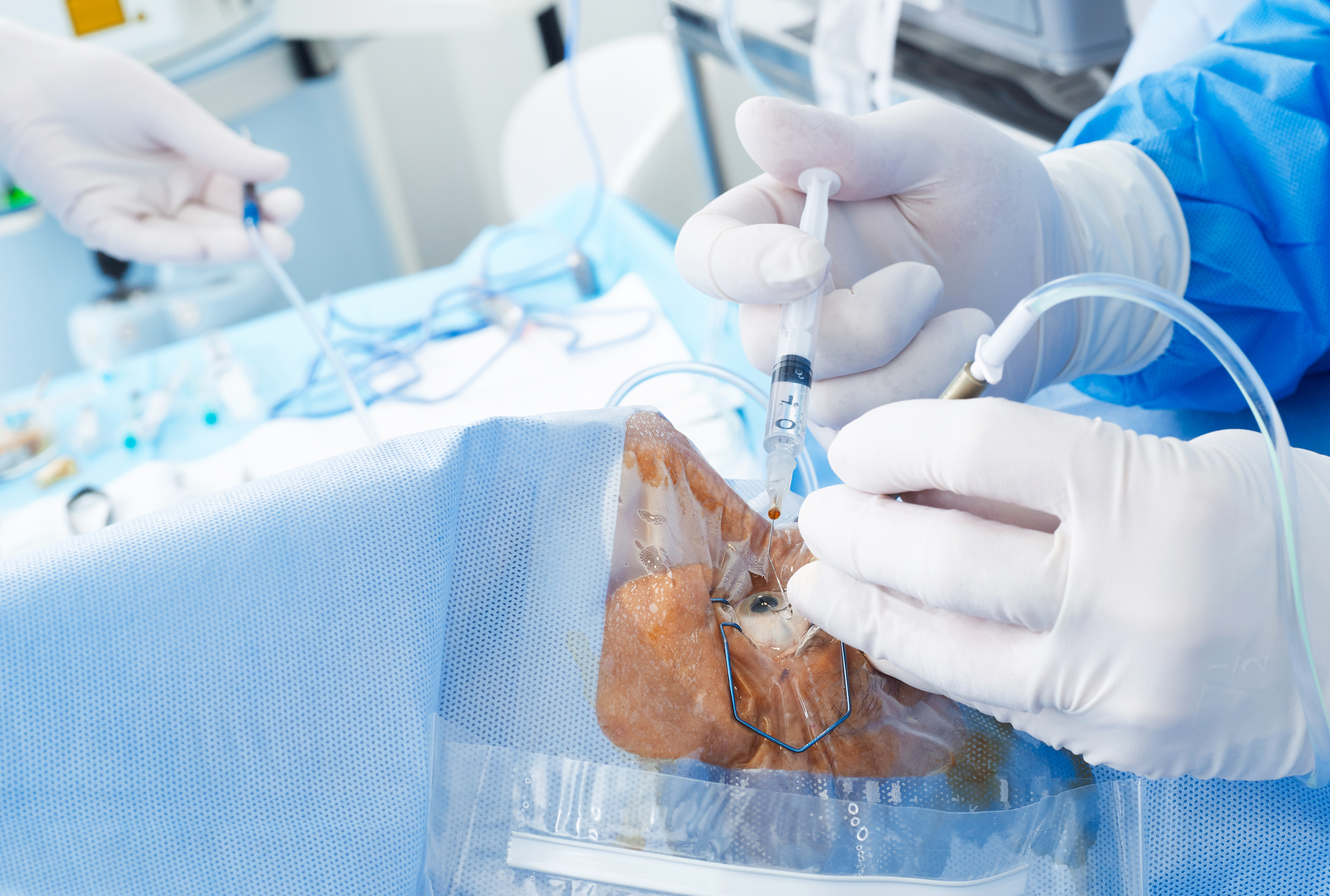 How Many Surgeries Equal Surgical Proficiency? 