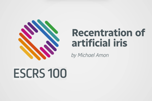 Recentration of artificial iris - Michael Amon