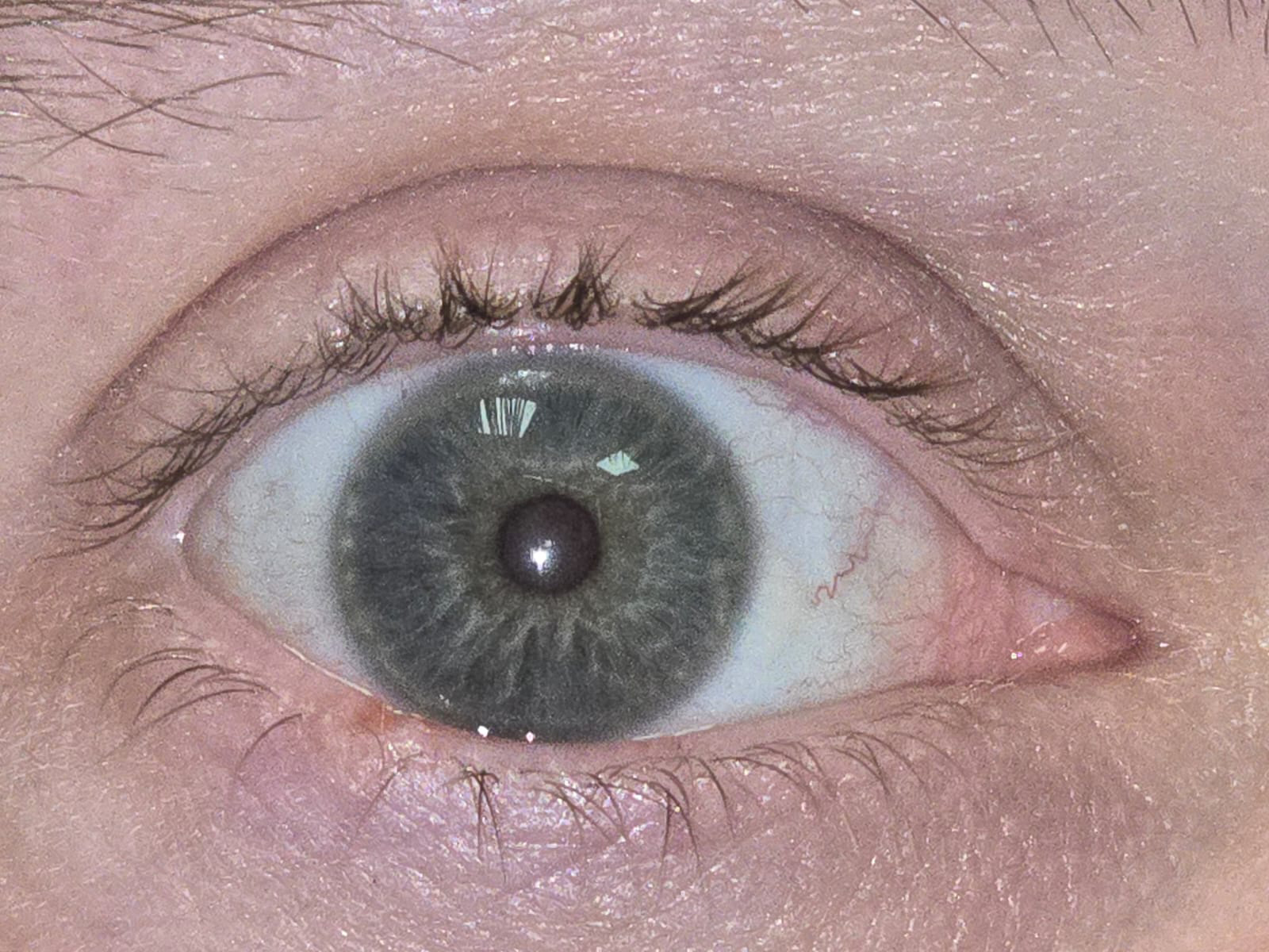 Lids: Lumps to Watch For