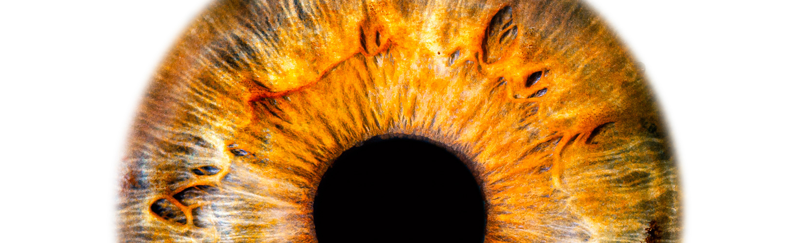 Banner image for Knowing Iris Repair: Aniridia