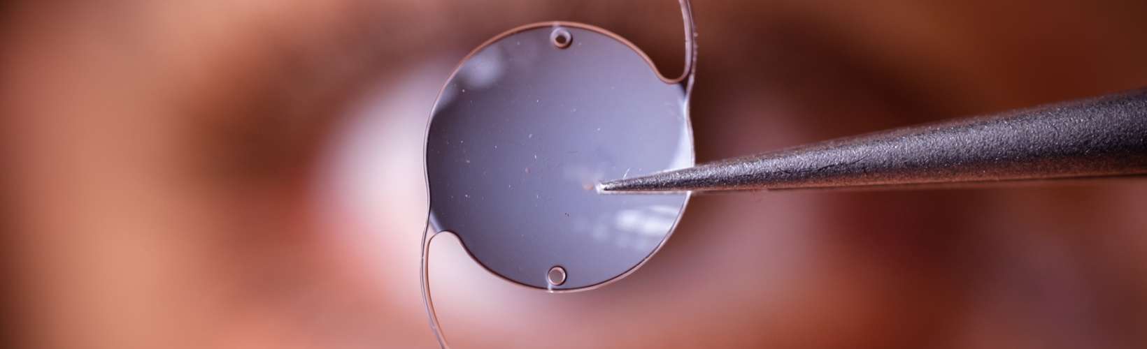 Banner image for A Second Look at the First IOL Implantation