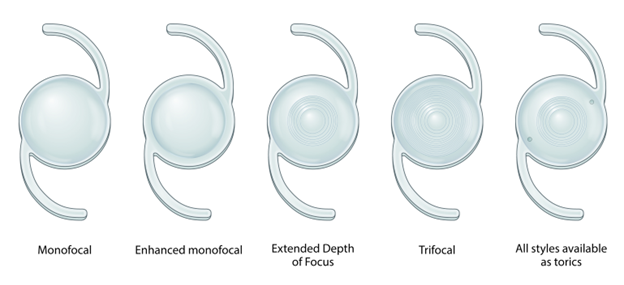 Different types of IOL