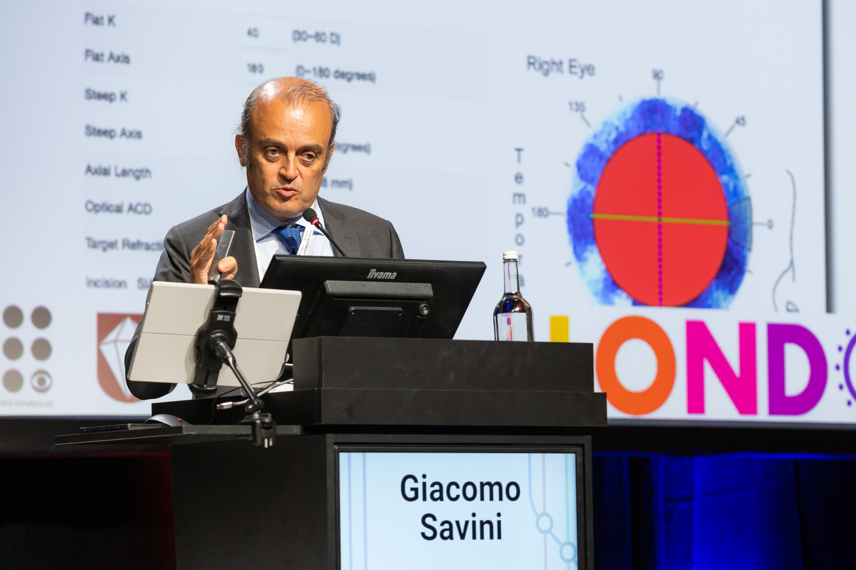 The Pursuit of Precision in Refractive Lens Exchange