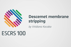 Descemet membrane stripping - Viridiana Kocaba