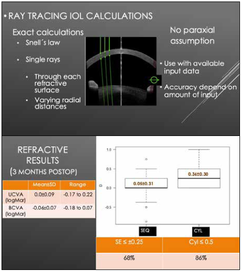 Escrs Optimising Outcomes Of Cataract Surgery In Challenging Cases