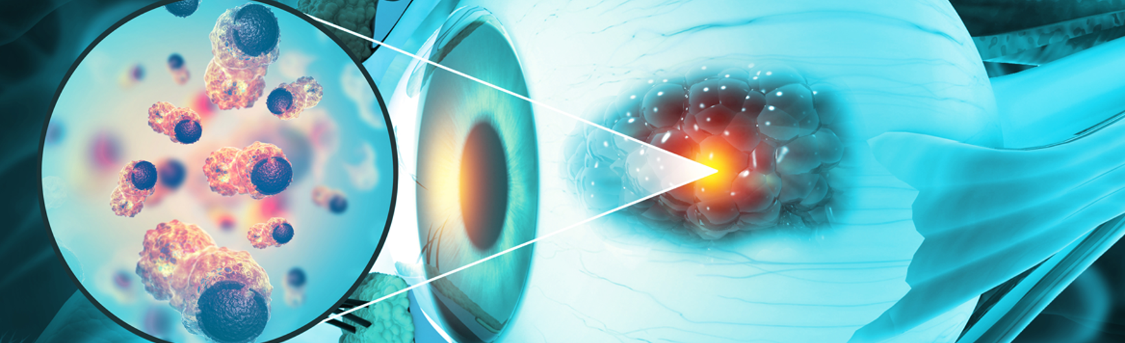 Periocular Cancer Treatment: From Control to Prevention