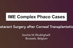 Phaco Complex Case Series: Cataract Surgery after Corneal Transplantation
