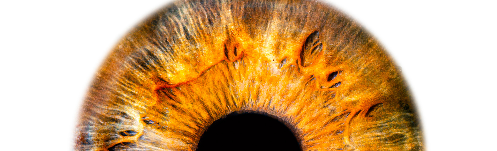 Banner image for Knowing Iris Repair: Post-Therapeutic PK for Corneal Ulcer