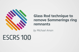 Glass Rod technique to remove Sommerings ring remnants -Michael Amon